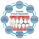 50ML Damaged Gum RepairCare Gel Serum Relieve Sore Gums Allergy Deep Cleaning Teeth Stains Tartar Serum Dental Caries Toothpaste